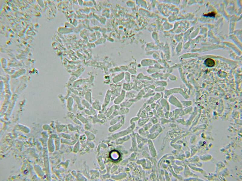 Ceriporia camaresiana 10 - Himenio KOH-004